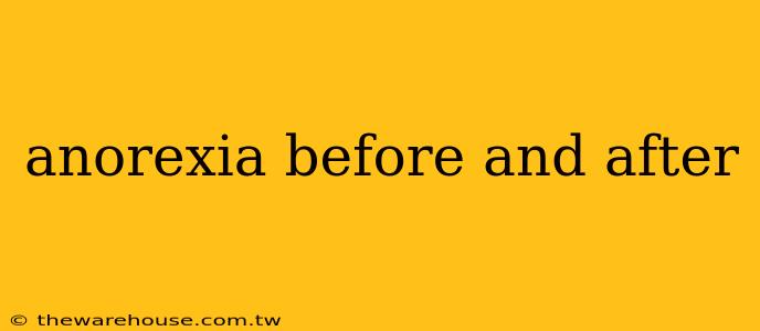 anorexia before and after